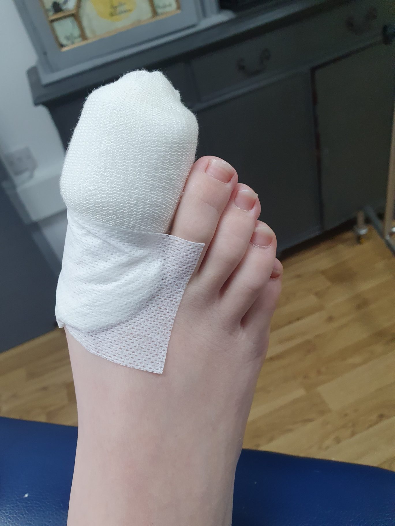 Bandaged toe after nail surgery