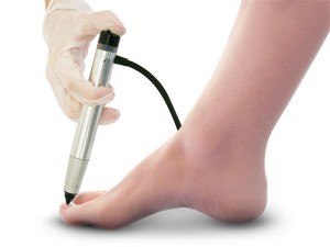 Clearanail probe on foot