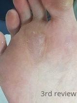 Foot at 3rd review